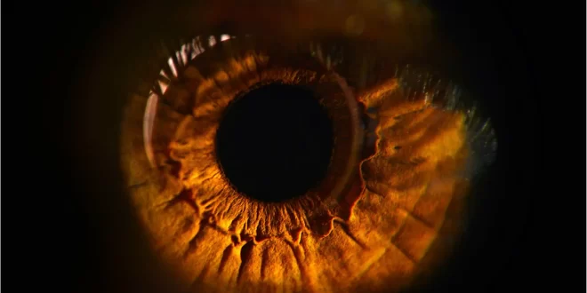 بحث جديد يربط السمنة بأمراض العين المسببة للعمىألقت دراسة جديدة من كندا ، نُشرت في مجلة Science الشهيرة ، الضوء على سبب جزيئي محتمل للضـ..