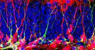 اكتشف فريق من علماء الأحياء كيفية إيقاظ الخلايا الجذعية العصبية وإعادة تنشيطها في الفئران البالغة.تحتوي بعض مناطق الدماغ البالغ على خلايا جـ.